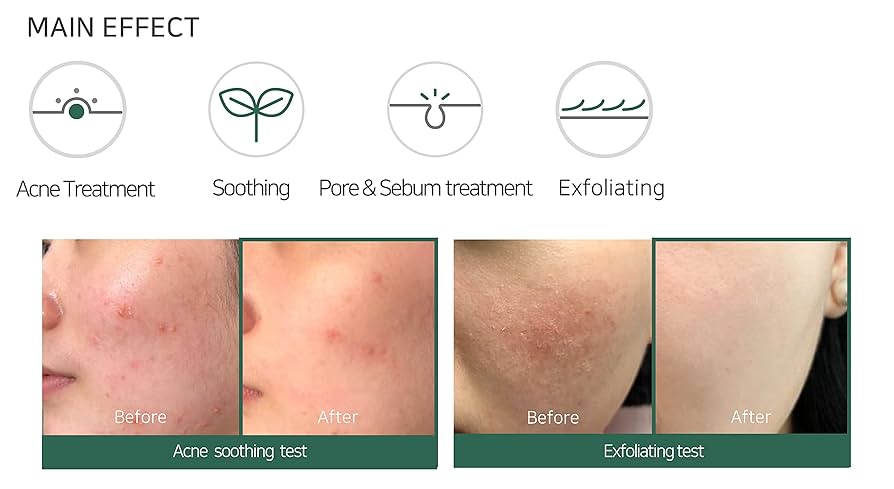 Some By Mi AHA BHA PHA 30 Days Miracle Acne Clear Foam
