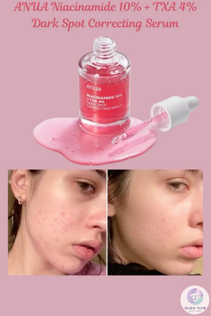 Anua, Niacinamide 10% + TXA 4% Dark Spot Correcting Serum