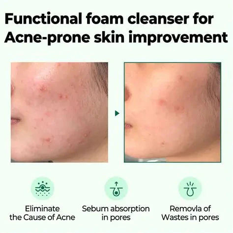 AHA.BHA.PHA 30 Days Miracle Travel Kit