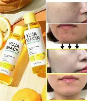 SOME BY MI - Yuja Niacin 30 Day Miracle Brightening Toner