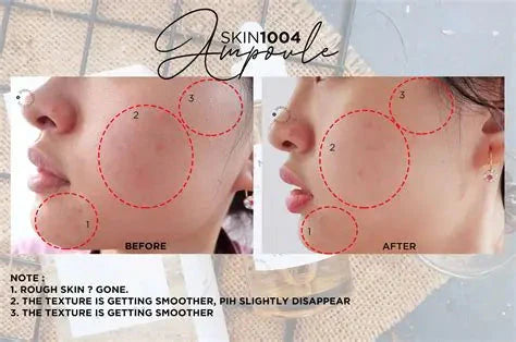 Centella Tone Brightening Capsule Ampoule