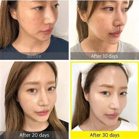SOME BY MI - Yuja Niacin 30 Days Brightening Starter Kit 4 pcs