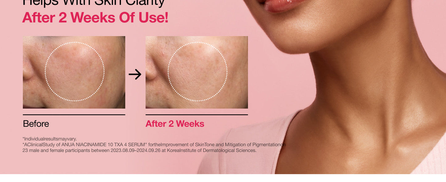 Anua, Niacinamide 10% + TXA 4% Dark Spot Correcting Serum
