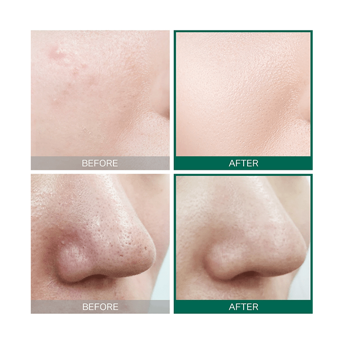 Some By Mi AHA. BHA. PHA 30 Days Miracle Toner