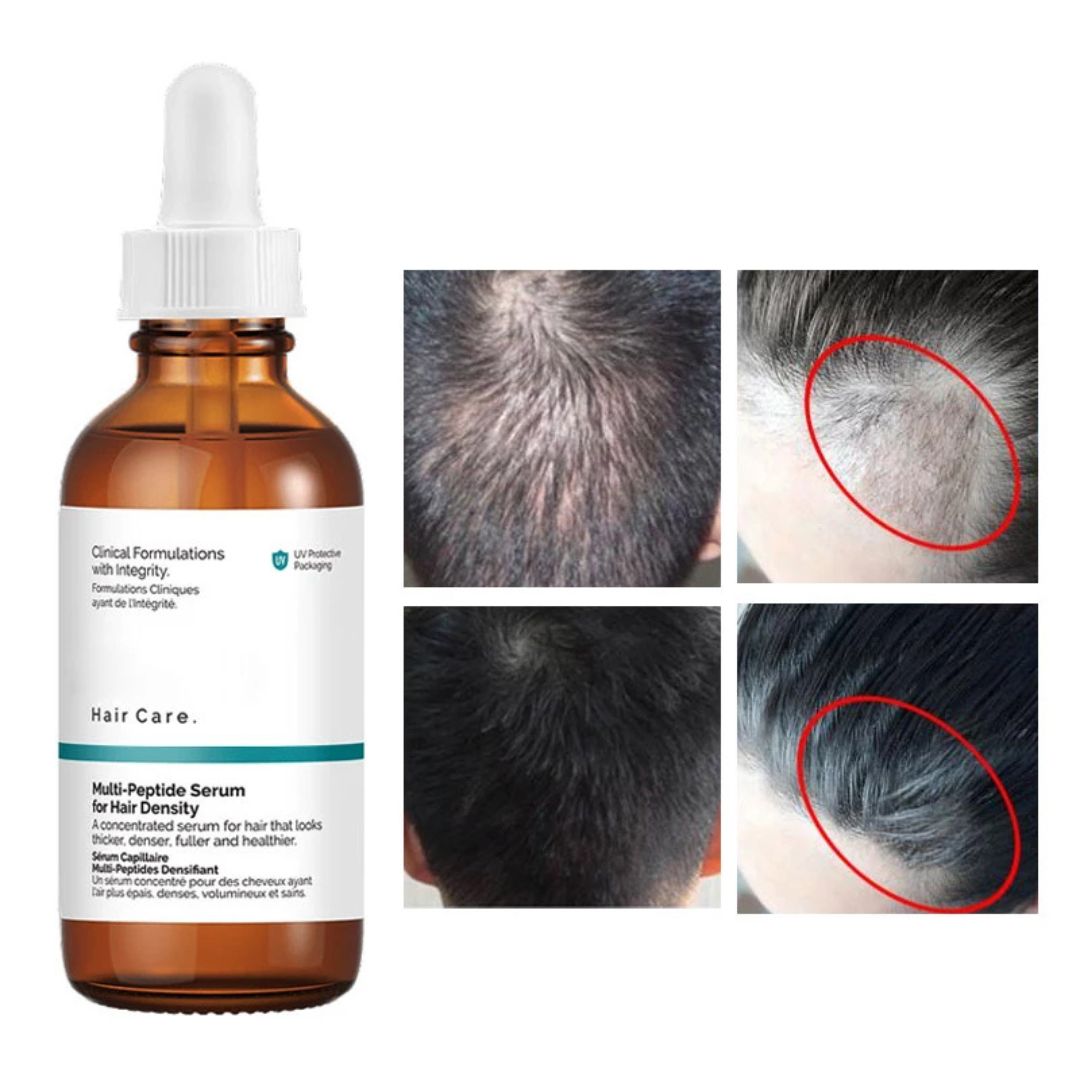 THE ORDINARY Multi-Peptide Serum for Hair Density