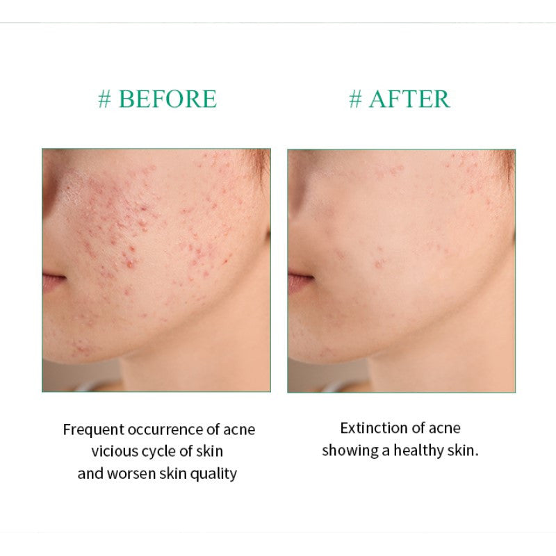 AHA.BHA.PHA 30 Days Miracle Travel Kit