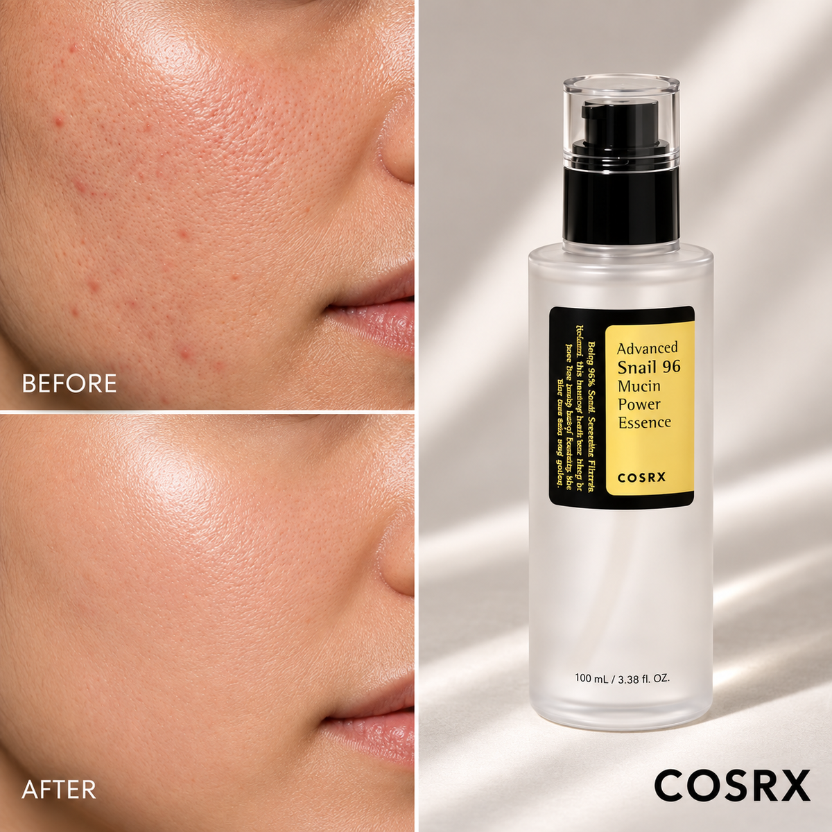 COSRX Advanced Snail Duo – Snail 96 Mucin Power Essence 100ml + Snail 92 All In One Cream 100g | 40% OFF