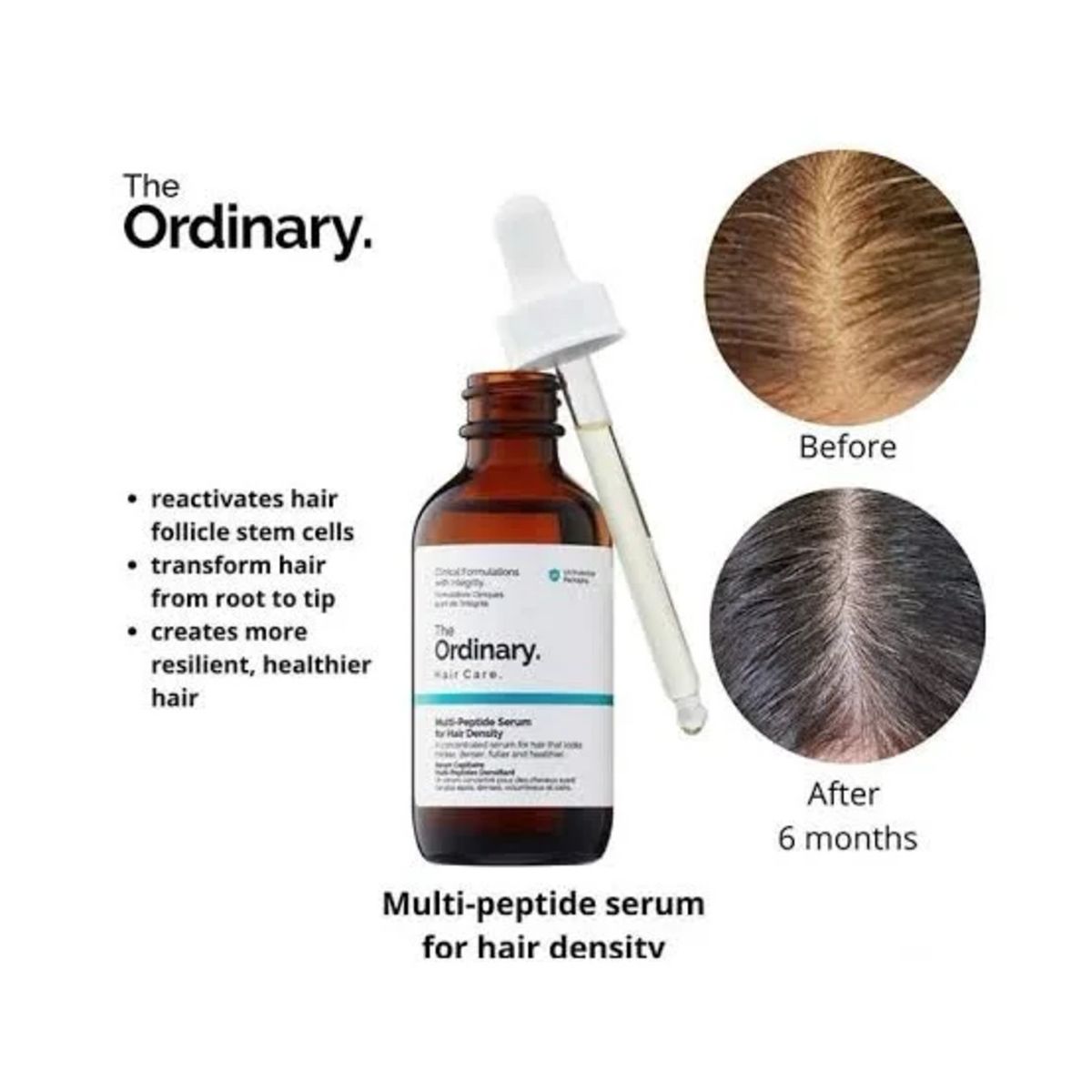 The Ordinary _ BUY 1 GET 1 Free